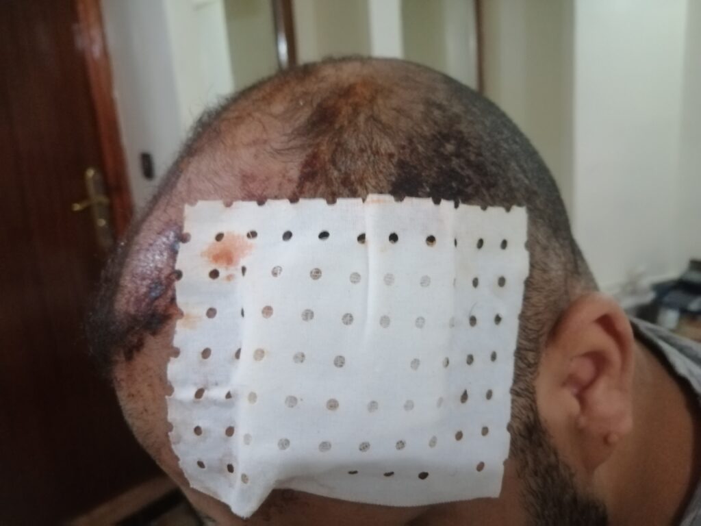 بعد تعرض فندق الرياض لإعتداء عصابة مسلحة، نداء عاجل للسلطات الأمنية بتكثيف الدوريات الأمنية بالفنادق السياحية 4 IMG 20240729 220138