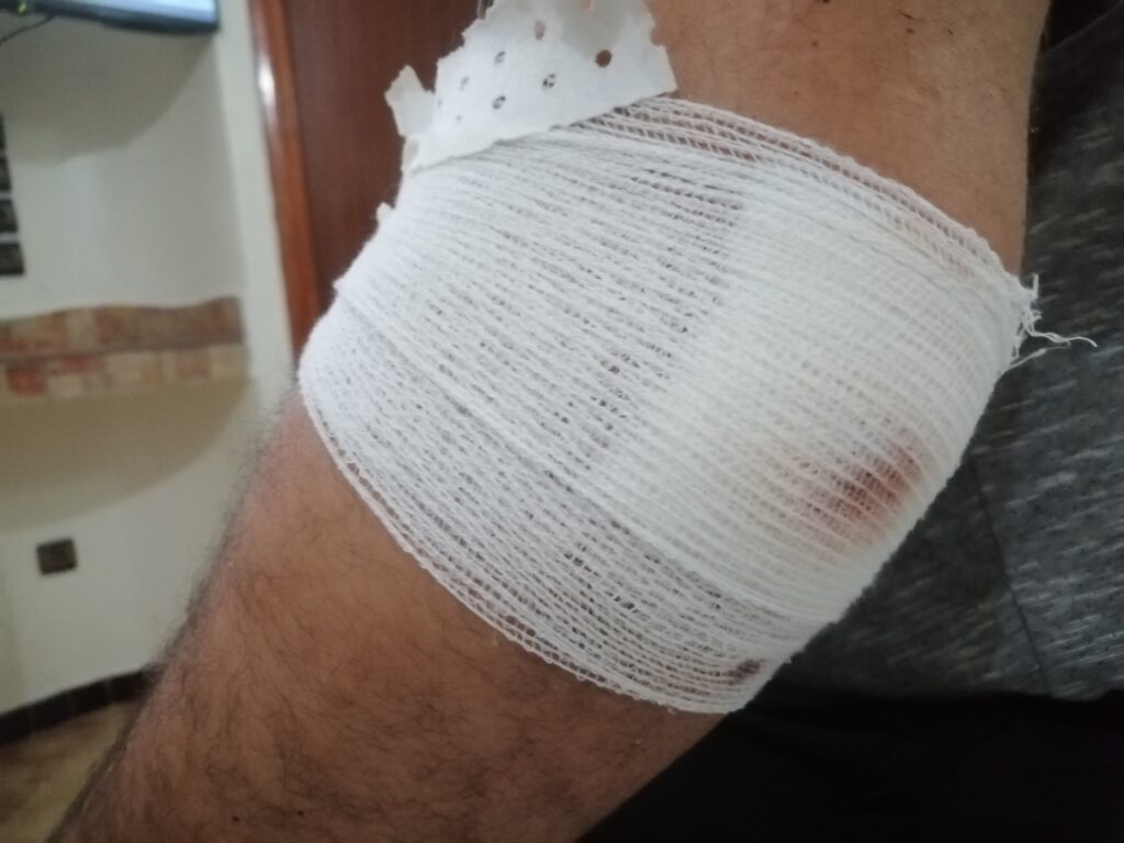 بعد تعرض فندق الرياض لإعتداء عصابة مسلحة، نداء عاجل للسلطات الأمنية بتكثيف الدوريات الأمنية بالفنادق السياحية 3 IMG 20240729 220146